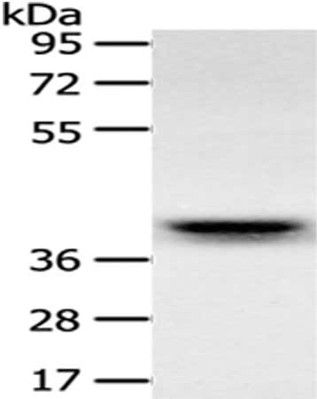 Anti-RFC2 Antibody