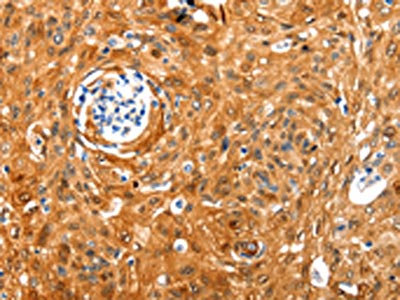 Anti-NCOR1 Antibody