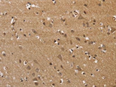Anti-KCNN4 / KCa3.1 Antibody