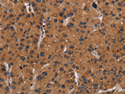 Anti-NRAS Antibody