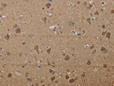 Anti-PTK2B / Pyk2 Antibody
