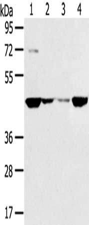 Anti-SMYD5 Antibody