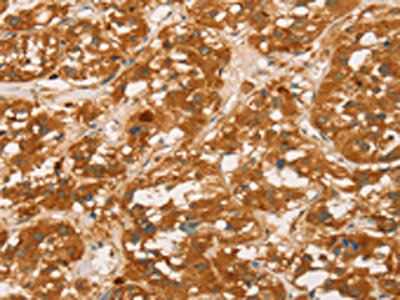 Anti-SPN Antibody