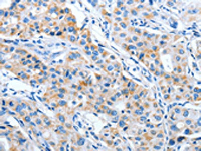 Anti-IMMT / MICOS complex subunit MIC60 Antibody