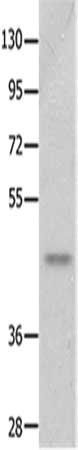 Anti-NTSR2 Antibody