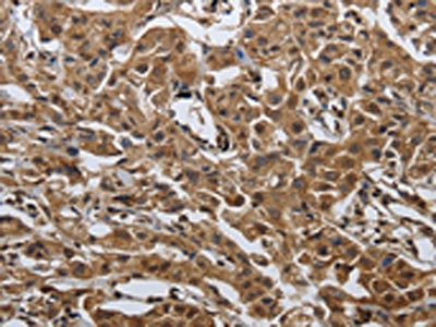 Anti-PDCD7 Antibody