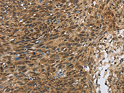 Anti-FOXB1 / Forkhead box protein B1 Antibody