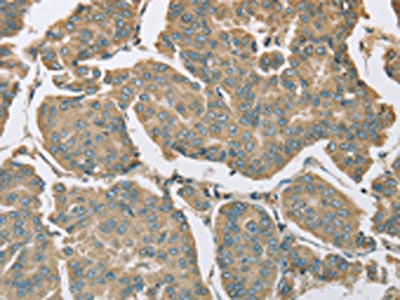 Anti-EIF5 / Eukaryotic translation initiation factor 5 Antibody