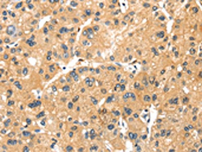 Anti-MAGEB2 Antibody