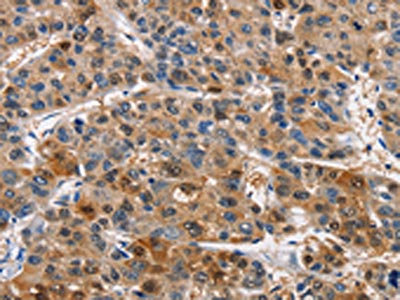Anti-PIM1 Antibody
