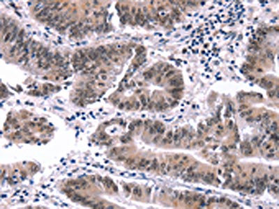 Anti-MYF5 Antibody