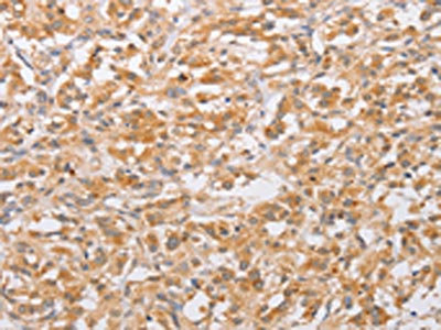 Anti-CSGALNACT2 Antibody