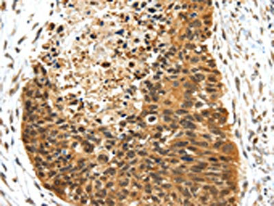 Anti-NR2F2 Antibody