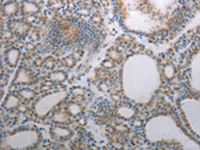Anti-RBMS3 Antibody