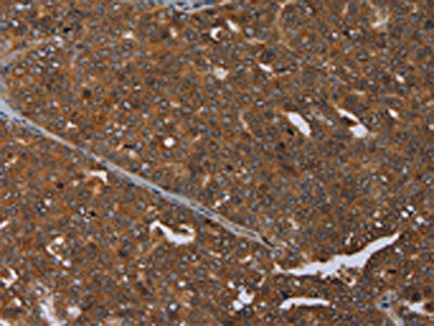 Anti-MCHR1 Antibody